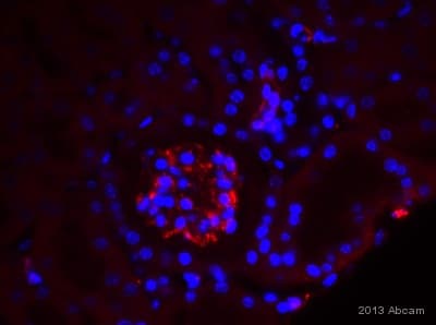 Anti-VEGFA antibody [EP1176Y] - C-terminal(AB52917)