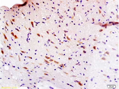 Semaphorin 3f Antibody Ab203394  Immunohistochemistry Formalin Pfa Fixed Paraffin Embedded Sections Img84433