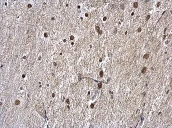 Anti-hnRNP A1 antibody(AB137780)