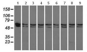 Pank2 Antibody Oti3h9 Ab119070  Western Blot Img34486