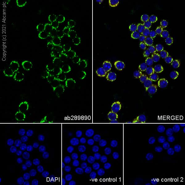 Anti-ATPB antibody [10/ATP](AB289890)