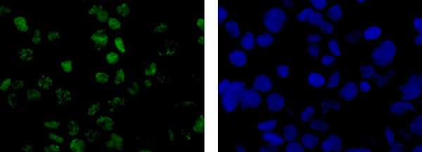 Anti-Wilms Tumor Protein antibody [CAN-R9(IHC)-56-2] - BSA and Azide free(AB216646)