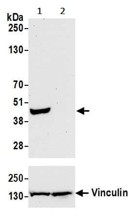 Indoleamine 2 3 Dioxygenase Antibody Blr040f Ab243896  Western Blot Img59532