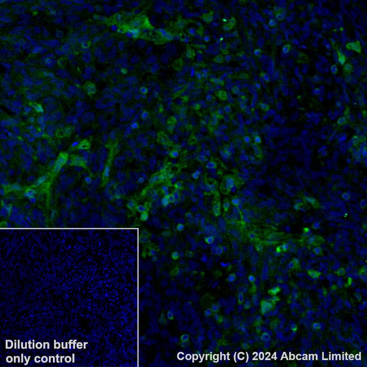Alexa Fluor 488 Gbp1 Antibody Epr8285 Ab320704  Immunohistochemistry Formalin Pfa Fixed Paraffin Embedded Sections Img435004