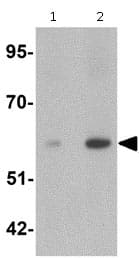 Anti-Angiopoietin 2/ANG2 antibody(AB125692)