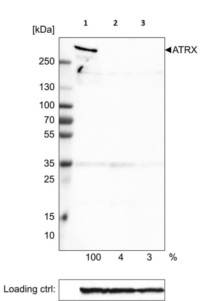 Anti-ATRX antibody [CL0537](AB188027)