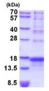 Recombinant Human AGRP protein (His tag)(AB202619)