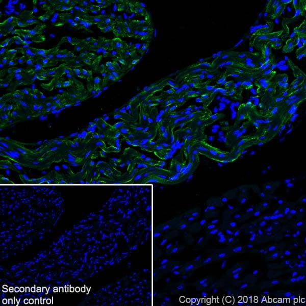 Natriuretic Peptides A Antibody Epr22089 283 Ab225844  Immunohistochemistry Frozen Sections Img83102