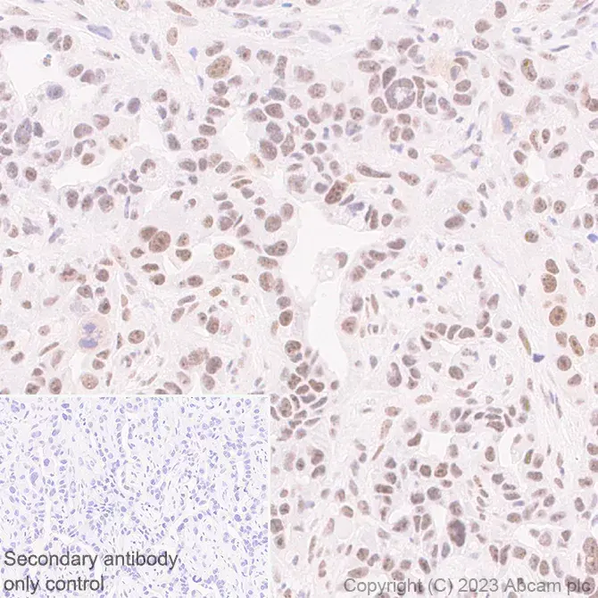 Anti-METTL16 antibody [EPR27236-78](AB313743)