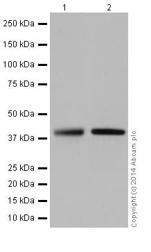 Anti-Glutamine Synthetase antibody [EPR16661](AB197024)