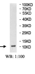 Anti-Osteocalcin antibody(AB93876)