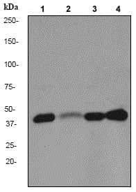 Anti-Cdk9 antibody [EPR3119Y](AB76320)