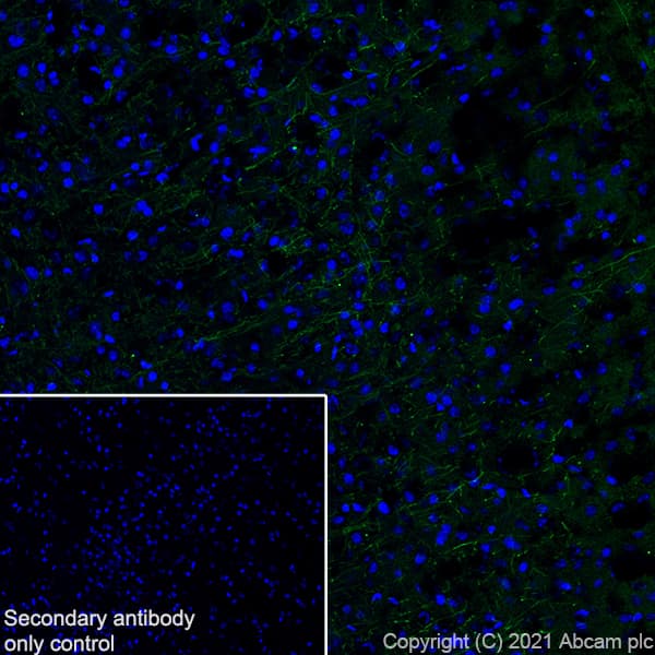 Myelin Plp Antibody Plpc 1 Ab9311  Immunohistochemistry Frozen Sections Img170412