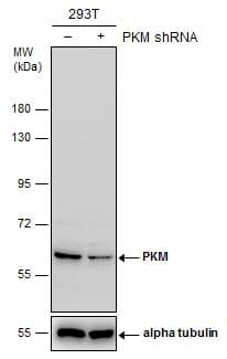 Pkm Antibody Ab137852  Western Blot Img107754