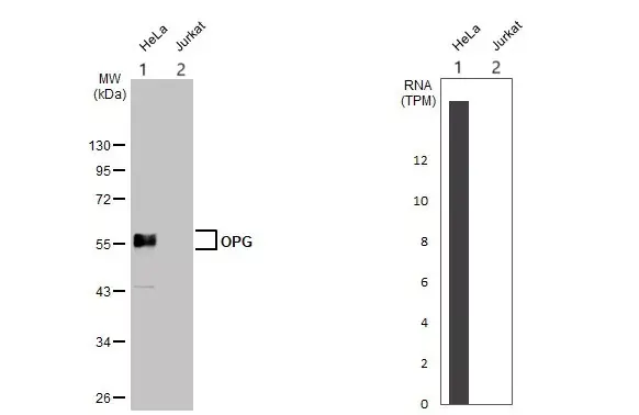 Anti-Osteoprotegerin antibody(AB183910)