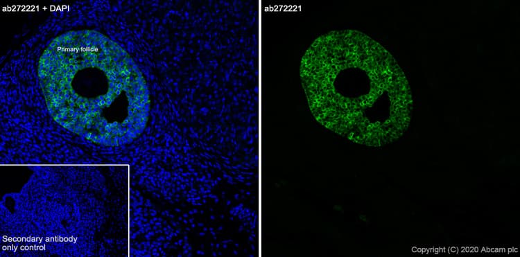 Anti-AMH antibody [EPR23380-171](AB272221)