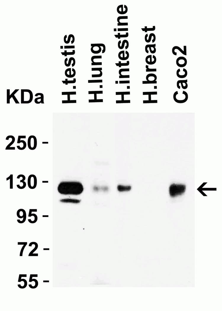 Anti-ACE2 antibody(AB15348)