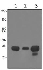 Anti-HLA-DR antibody [EPR3692](AB92511)