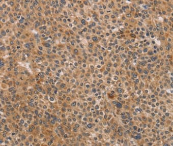 Cdk11a Cdk11b Antibody Ab198813  Immunohistochemistry Formalin Pfa Fixed Paraffin Embedded Sections Img37683