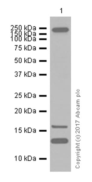 Sdhc Antibody Epr11035b Ab155999  Western Blot Img86349