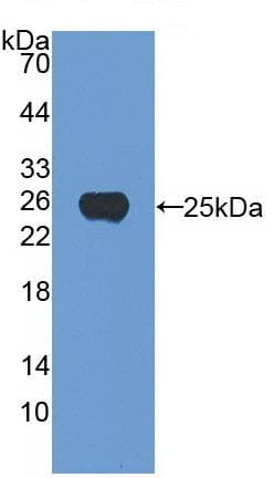 Anti-Noggin antibody [A11](AB239520)