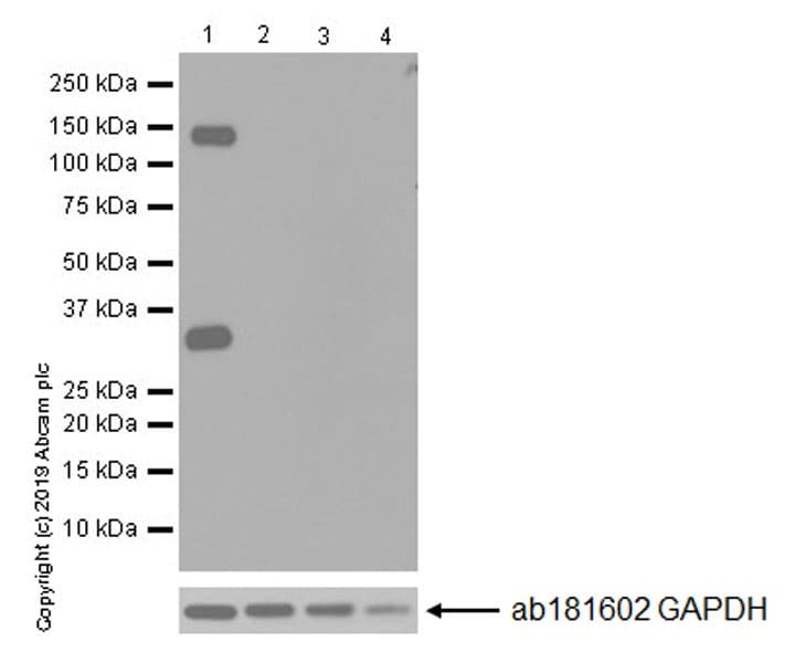 Anti-Pan Trk antibody [EPR17341-4](ab246551)