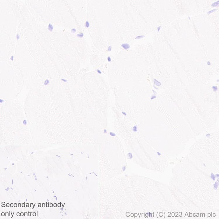 Anti-MCP1 antibody [RM1100](AB315478)