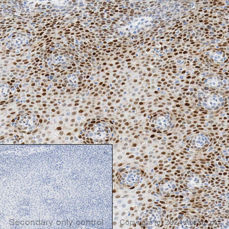 Anti-Cyclin D1 antibody [EPR2241] - C-terminal(AB134175)