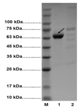 Albumin Depletion Kit(ab241023)