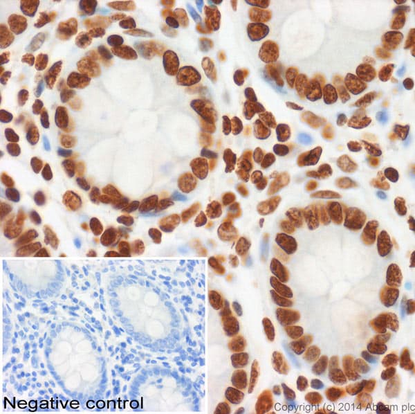 Anti-Histone H2A.X antibody - ChIP Grade(AB20669)