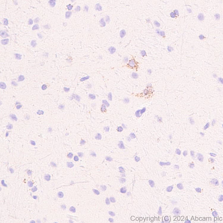 Anti-Slc25a1 antibody [EPR29193-92](AB318201)