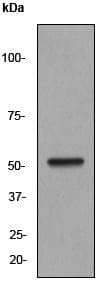 Anti-beta III Tubulin antibody [EP1569Y] - Neuronal Marker(AB52623)