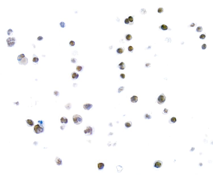 Anti-TOX antibody [BLR212K] - BSA free(AB314043)