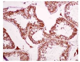 Cyb5r3 Antibody Epr3868 Ab133247  Immunohistochemistry Formalin Pfa Fixed Paraffin Embedded Sections Img21446