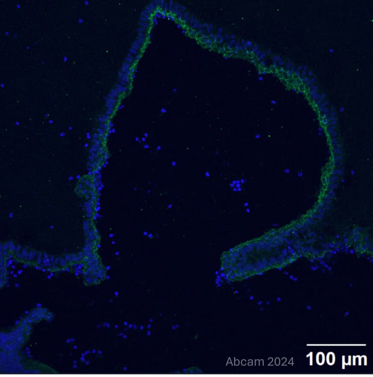 Anti-Occludin antibody [EPR20992](AB216327)