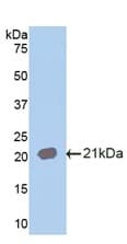 Anti-IL-18R1 antibody(ab231565)