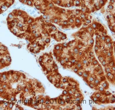 Anti-TOMM20 antibody - Mitochondrial Marker(ab78547)
