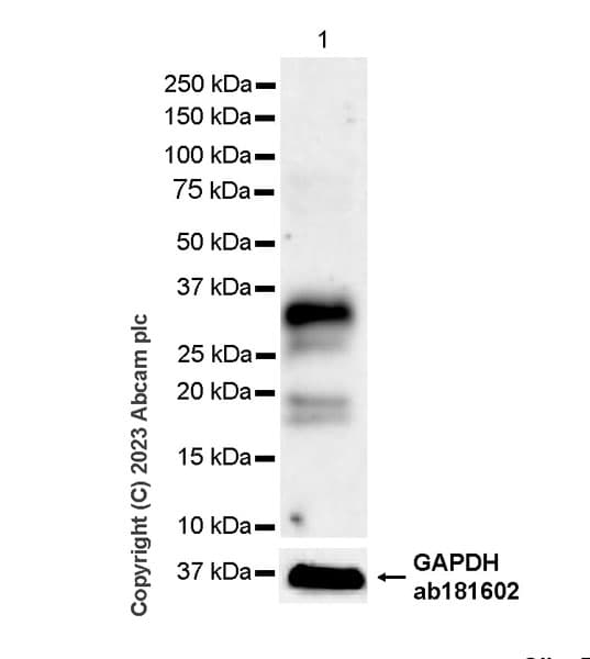 Anti-Neutrophil Elastase antibody [RM1077](AB314916)