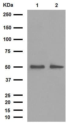 Anti-Desmin antibody [Y66] - Cytoskeleton Marker(AB32362)