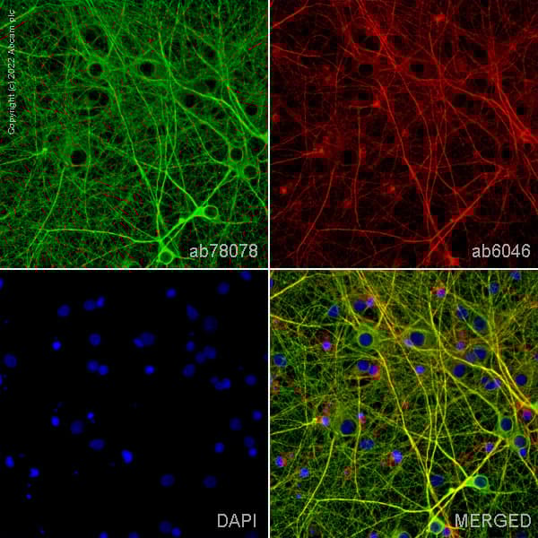 Anti-beta Tubulin antibody - Loading Control(AB6046)