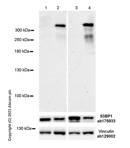 Anti-53BP1 antibody [EPR2172(2)](AB175933)
