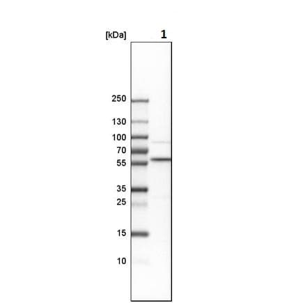 Anti-Proteasome 19S S4/PSMC1 antibody(AB223765)