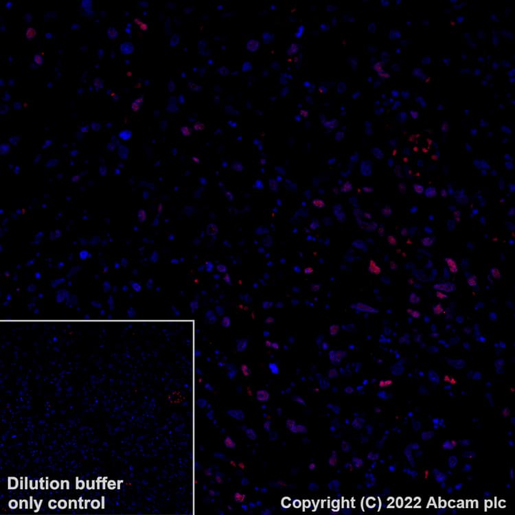 Alexa Fluor® 647 Anti-BATF3 antibody [EPR26558-38](AB307471)