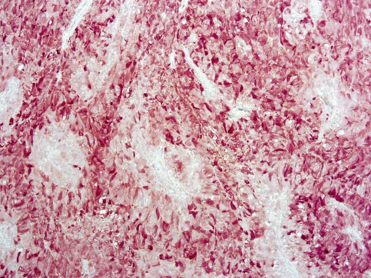 Anti-S100 antibody [4C4.9](AB4066)