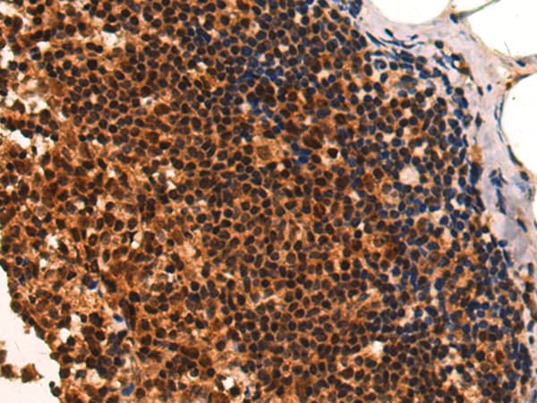 Anti-CAMTA1 antibody(AB199116)
