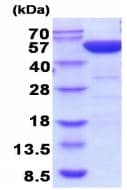 Recombinant human PGD protein(AB208326)