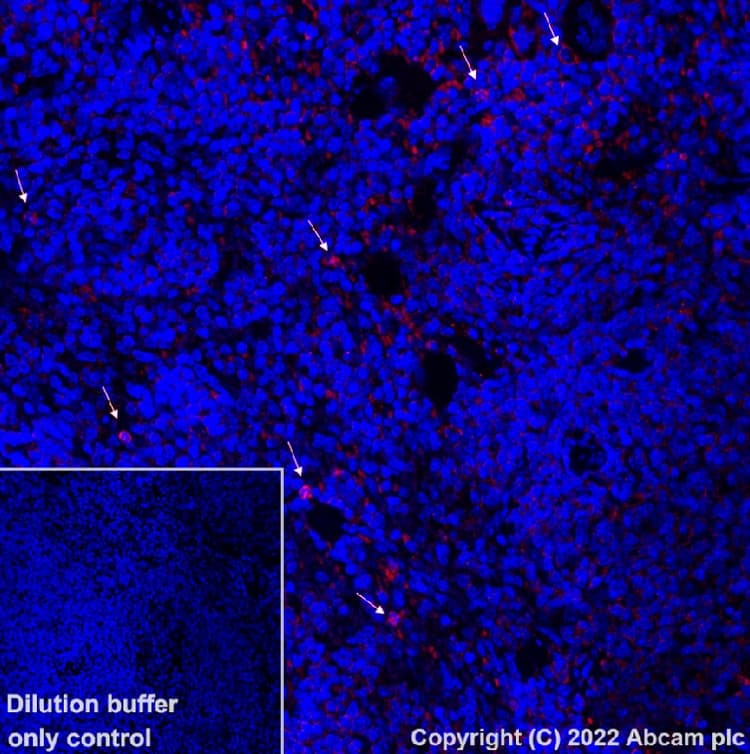 Alexa Fluor® 647 Anti-Ly6g antibody [EPR22909-135](AB303467)