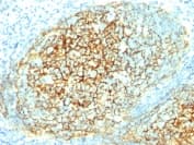 Vcam1 Antibody 14c3 Bsa And Azide Free Ab212937  Immunohistochemistry Formalin Pfa Fixed Paraffin Embedded Sections Img128357