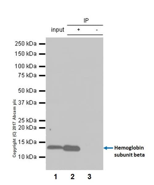 Hemoglobin Subunit Beta Antibody Epr20614 Bsa And Azide Free Ab240390  Immunoprecipitation Img5122