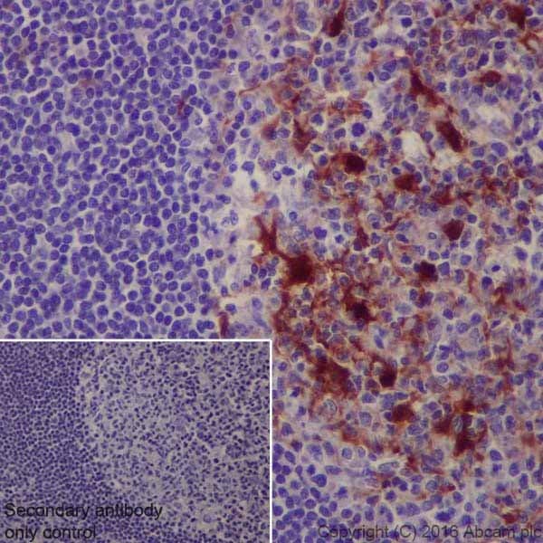 S100 Alpha Antibody Epr19013 Ab183979  Immunohistochemistry Formalin Pfa Fixed Paraffin Embedded Sections Img93164